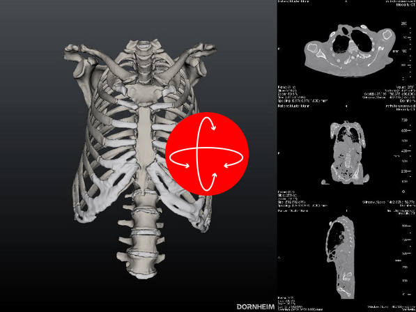 View Scapula in Viewer