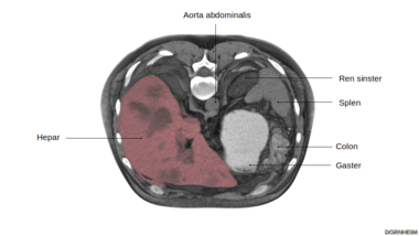 Liver: Horizontal section through the abdomen