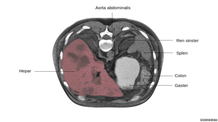 Leber: Horizontalschnitt durch das Abdomen