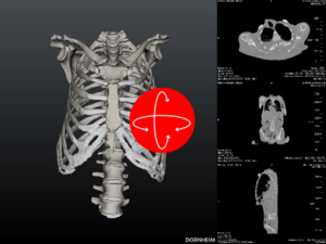 Scapula im Viewer betrachten