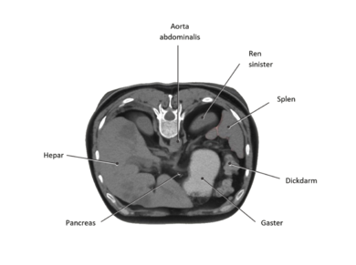 Spleen: Position of the spleen in horizontal incision